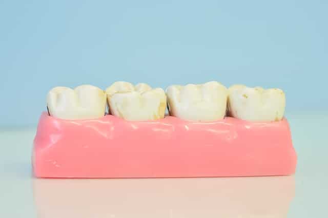 רופא שיניים - אילו טיפולים חשוב לעשות באופן קבוע