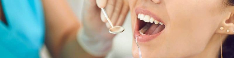 אלו הדברים שחשוב לשים לב כאשר בוחרים מרפאת שיניים